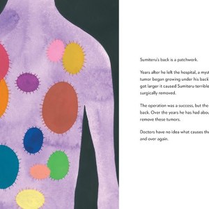 sumiteru_injured_back